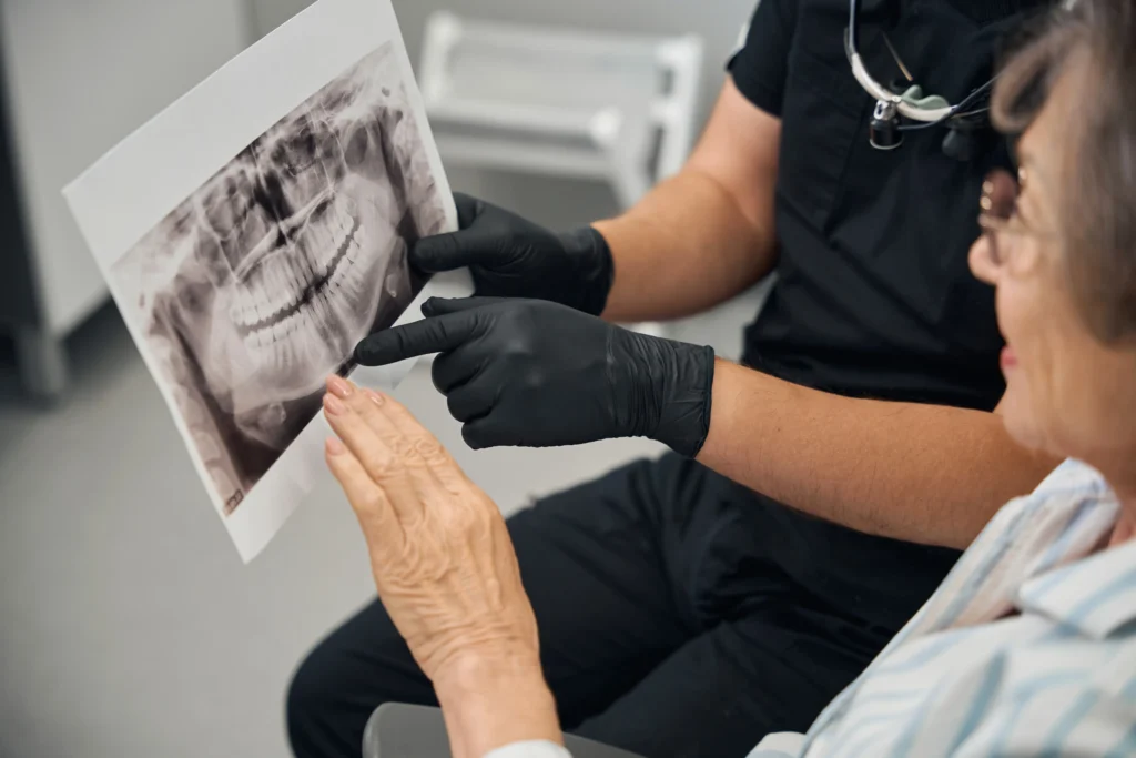 Rehabilitación Oral 1